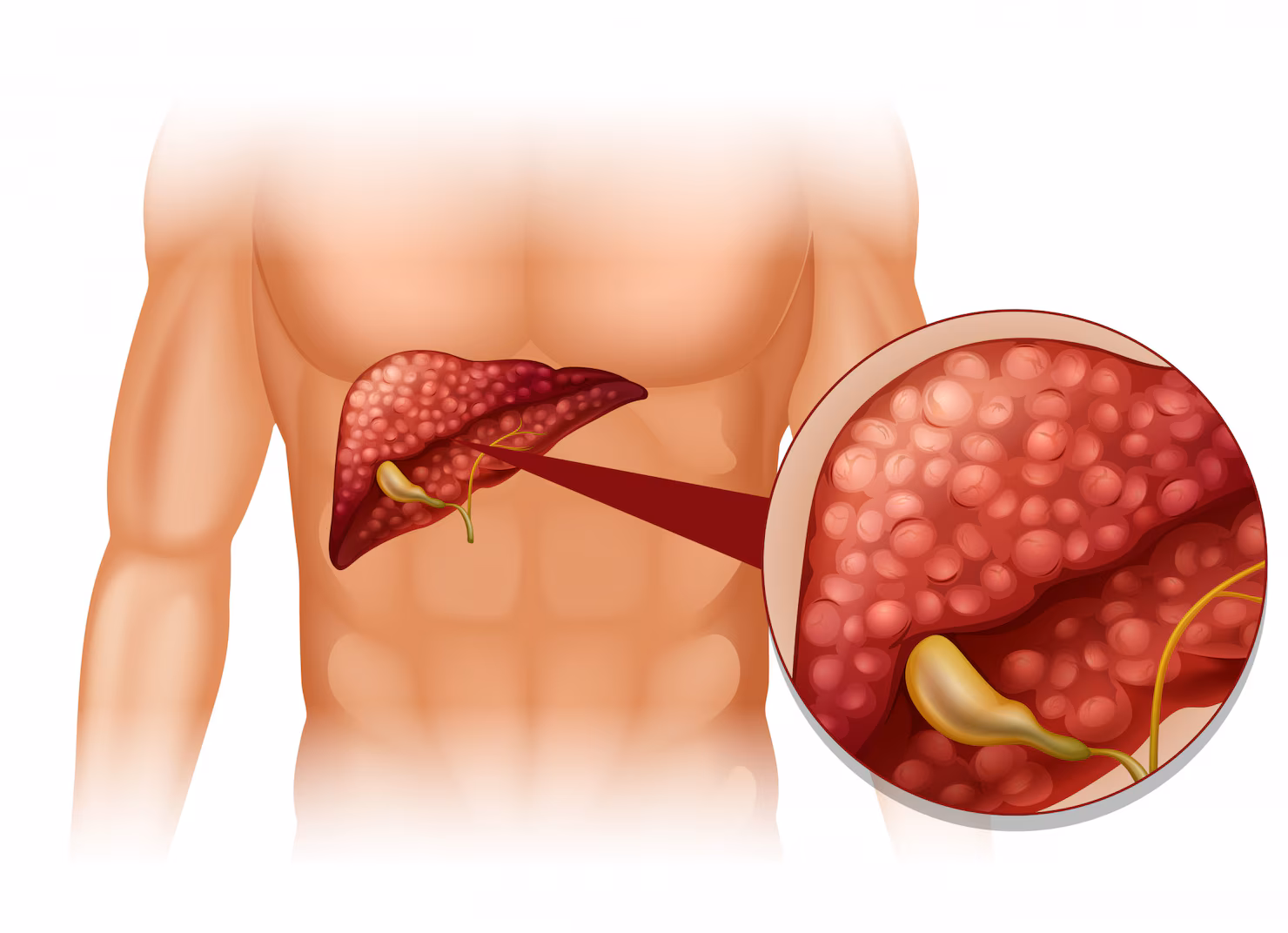 Liver-Transplant Services