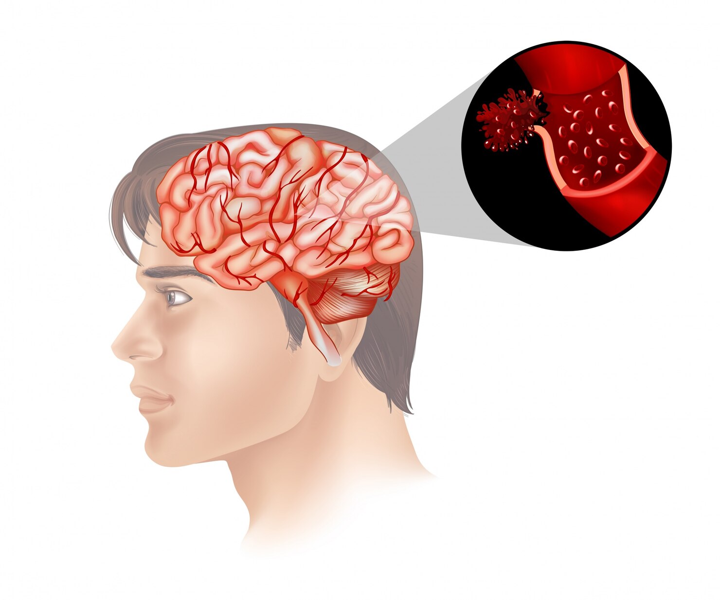 Brain Tumour Treatment Services