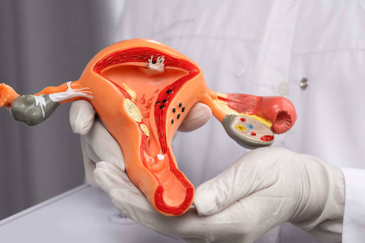 Cervical Cancer Treatment Services